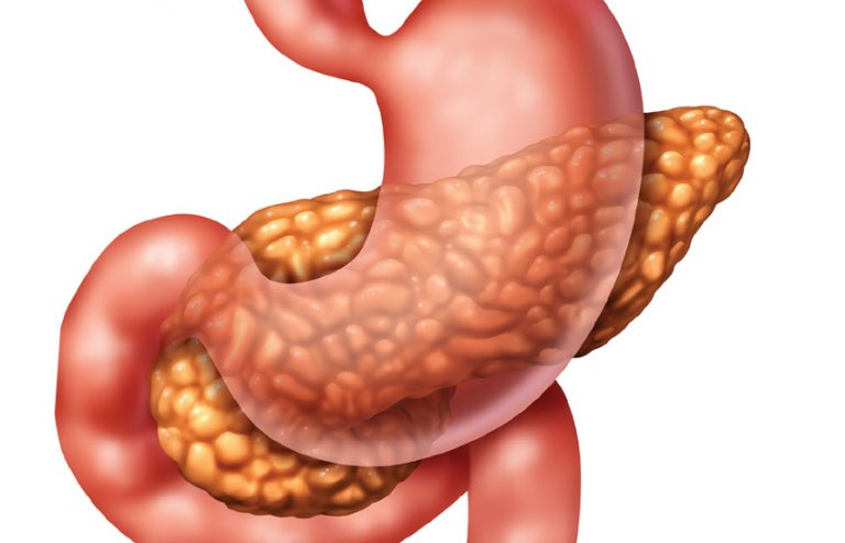 Pancreatitis: Signs & Symptoms - This Quarterly