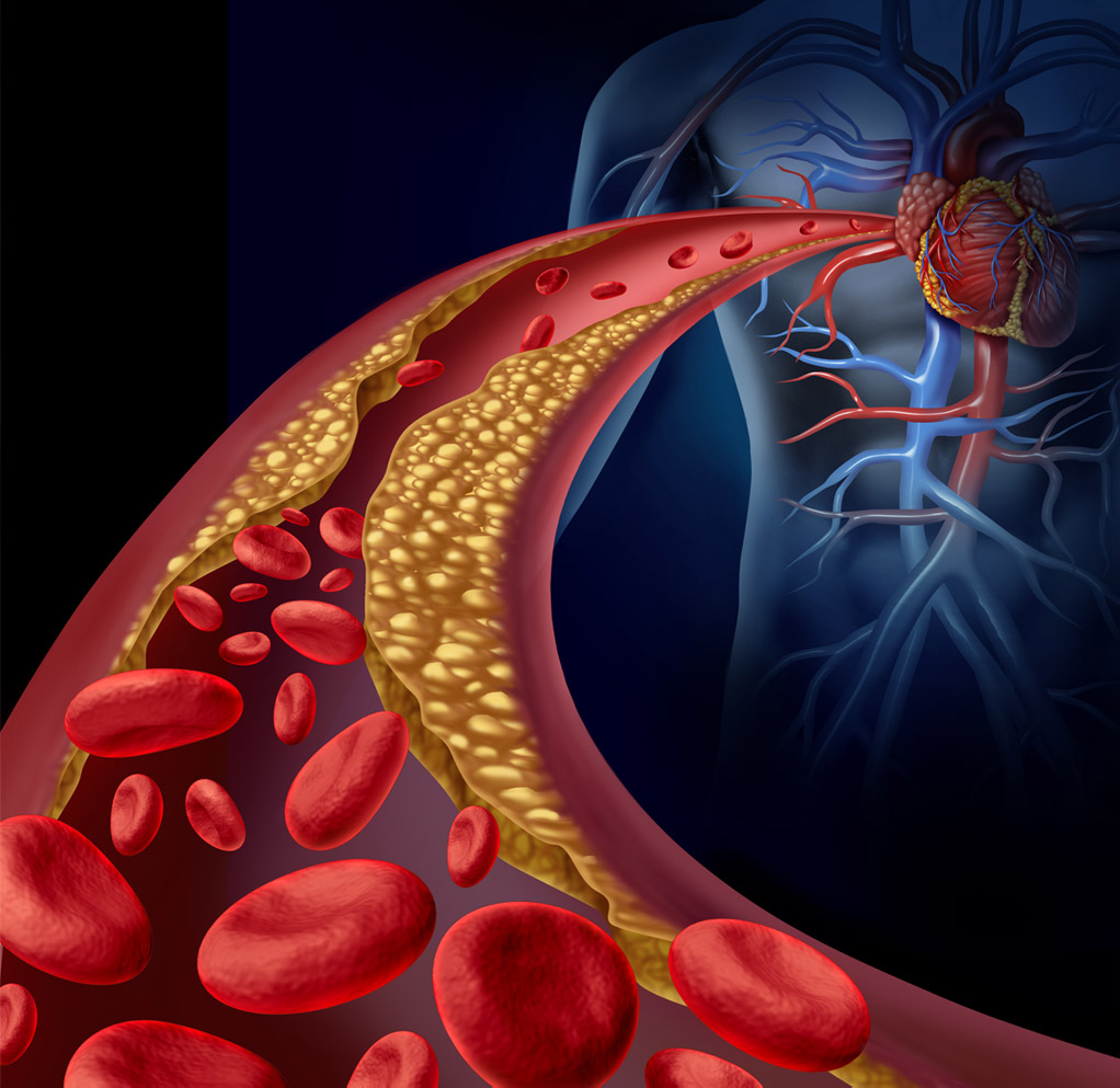 the-diabetes-heart-disease-connection-this-quarterly